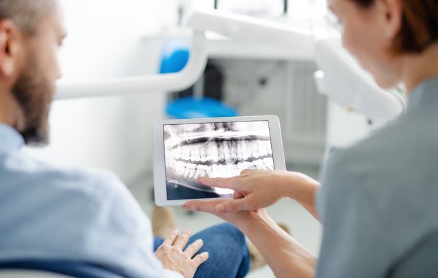 free x ray dental implant